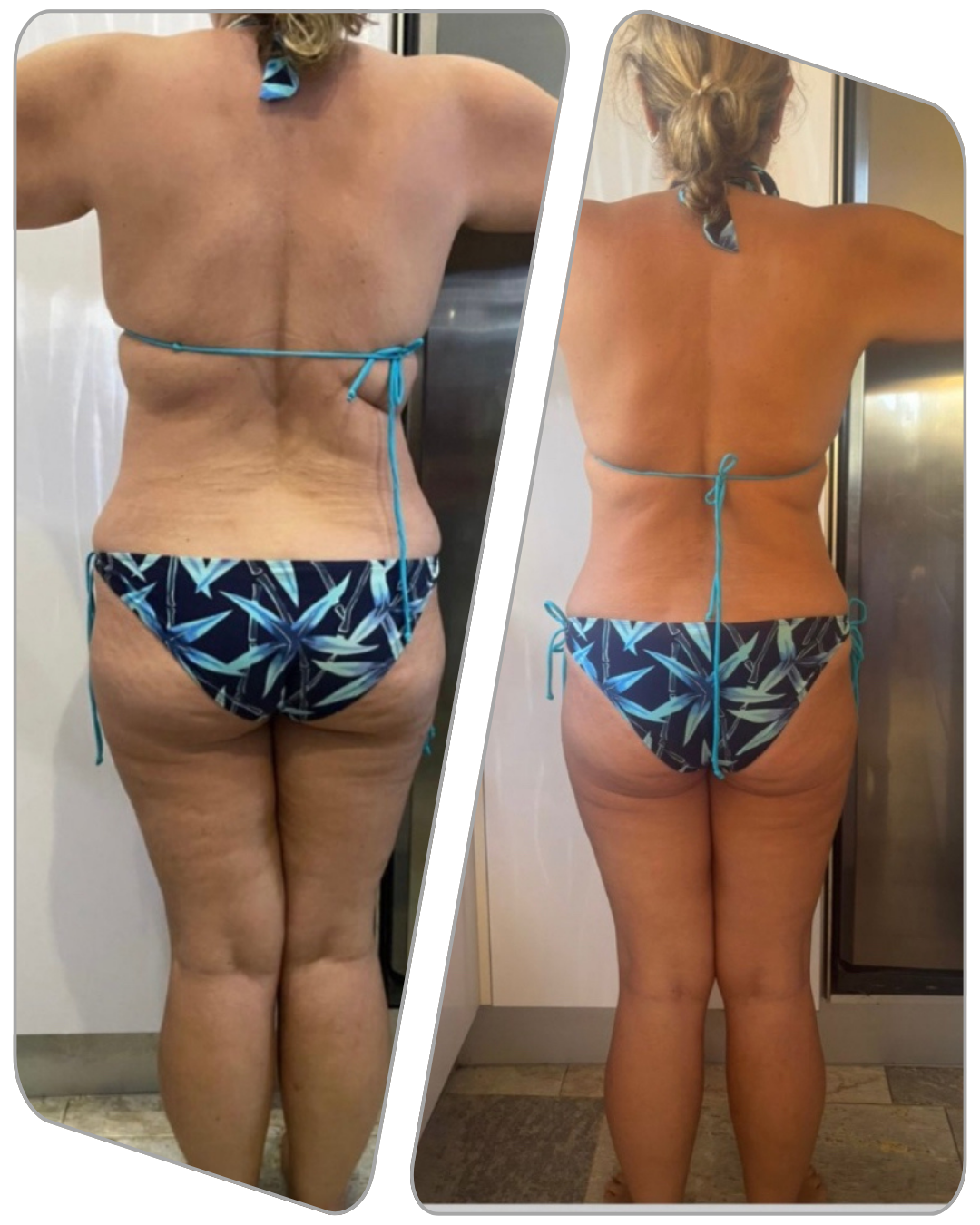 " CON 15 KGS MENOS MIS COMPLEJOS HAN DESAPARECIDO "