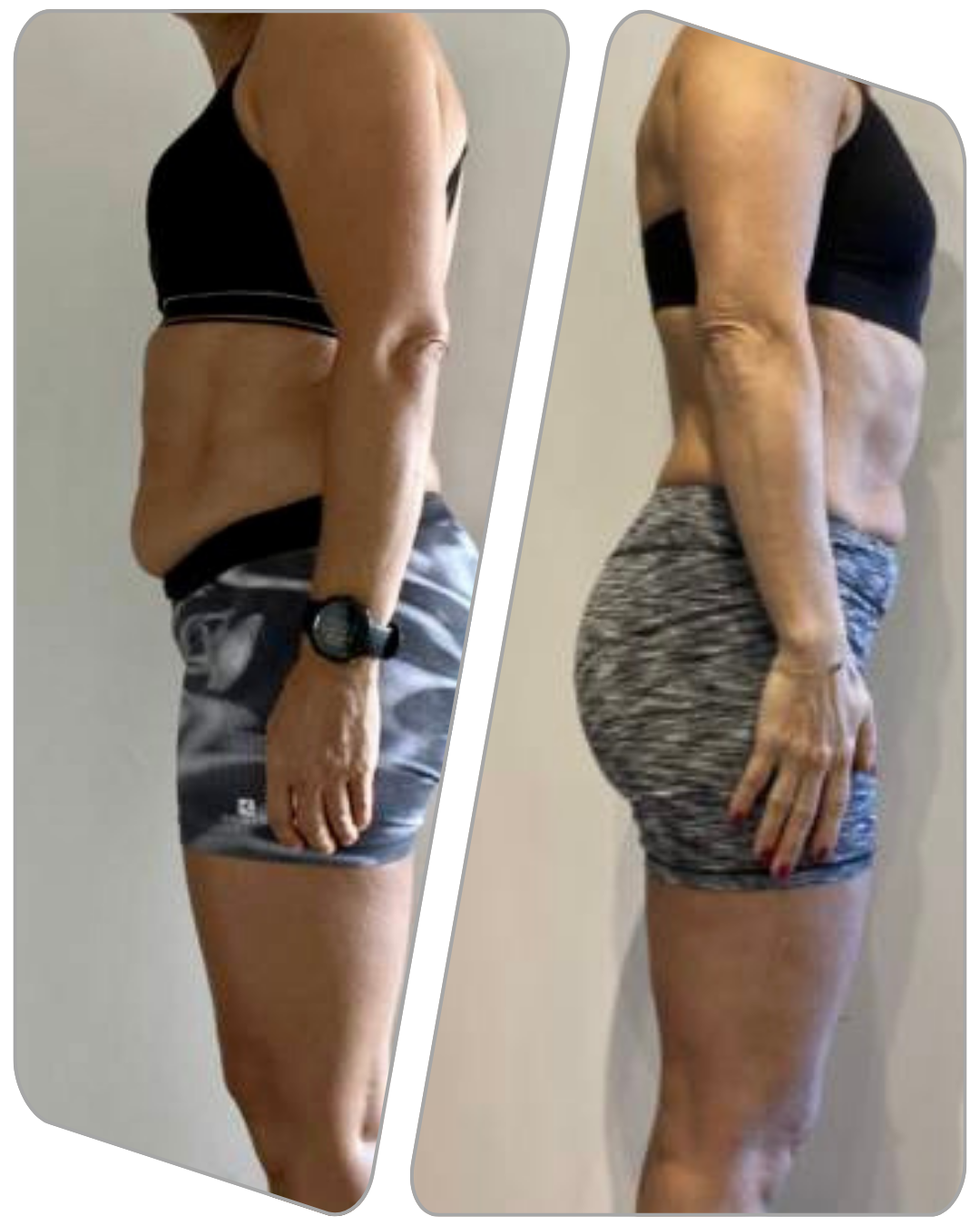 " ENTRENABA Y NO VEIA RESULTADOS Y AL EMPEZAR CON RAFA POR FIN MI BARRIGA DESAPARECIO "