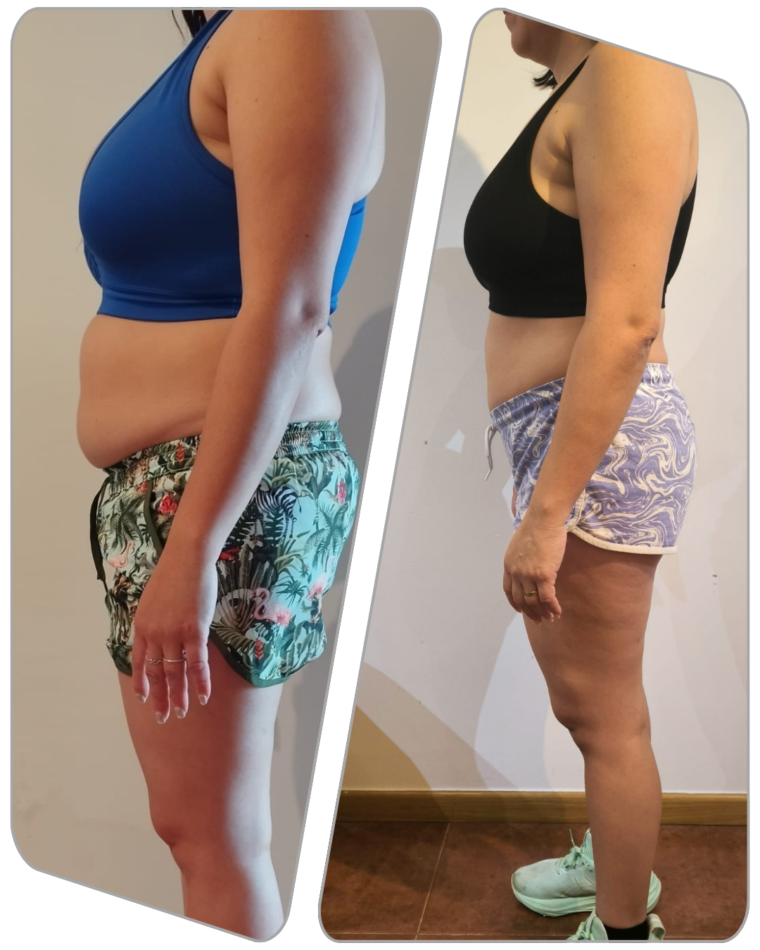 " LLEVABA AÑOS ESTANCADA CON MI BARRIGA Y POR FIN YA NO ES UN PROBLEMA "