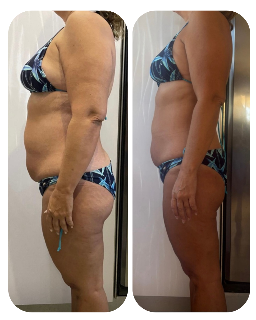 " VOLVER A RECUPERAR MI ENERGÍA Y QUITARME LA BARRIGA ES LO QUE LLEVABA INTENTANDO AÑOS "